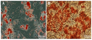 <p>Figure 3. Multilineage differentiation of BMSC, A) Adipogenic dif-ferentiation of BMSC (Oil Red O stain of lipid droplets). B) Osteo-genic differentiation of BMSC; (Alizarin Red Stain for calcium). Scale bars 10 <em>&mu;m.</em></p>