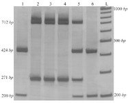 <p>Figure 2. Results of T-ARMS-PCR of <em>ACE</em> polymorphisms (rs4043 and rs4343). Lanes 1 and 6: DDGG genotype, lanes 2, 3 and 4: IIAA genotype and lane 5: DIAG (IA/DG) genotype.</p>