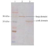 <p>Figure 4. Western blot analysis of the recombinant loop and cork domains from BauA. Lane 1: molecular weight marker, Lane 2: purified loop domain, Lane 3: purified cork domain</p>