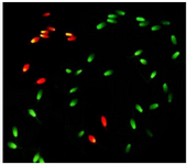 <p>Figure 1. Stallion sperm stained with 1% Acridine Orange (AO). Sperm with normal chromatin structure display green fluorescence and those with an abnormal DNA (Single-strand) shows a yellow to red fluorescence color.</p>
