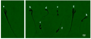 <p>Figure 2. Sperm morphology using Diff-Quik. Sperm with normal. a) and abnormal morphologies (b-h). b) bent midpiece; c) abnormal midpiece; d) bent tail; e) tailless head; f) proximal droplet; g) abnormal head; h) distal droplet.</p>