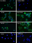 <p>Figure 3. Detection of sortilin expression using immunofluorescent</p>
<p>staining. MAb 2D8 detected sortilin (green color) in CLL but not in</p>
<p>healthy PBMCs. Sortilin was also detected in CLL cell lines (232-</p>
<p>B4, WA-C3CD5+ and I83-E95). Caov-4 ovarian cancer cell line was</p>
<p>used as positive control. Nuclei were counterstained with DAPI (blue</p>
<p>color).</p>