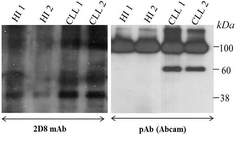 <p>Figure 6. Western blot shows the expression of sortilin in lysate of CLL and healthy PBMCs detected by either 2D8 mAb (left) or anti-sortilin pAb (Abcam, right). HI: healthy individual.</p>