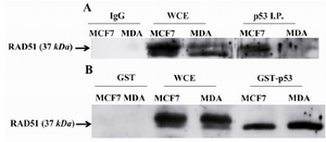 Figure 2. RAD51 only bound to wild type (WT) TP53 in vivo and in vitro. A) RAD51 bound to WT TP53 in MCF7 cell line but not to the mutated one in MDA-MB-468 (MDA) cells. Cell lysates were Immunoprecipitated with Ab against TP53 and IgG then analyzed by Western blotting with anti-RAD51. B) Mutated TP53 did not interfere with in vitro binding of WT TP53 to RAD51. RAD51 was pulled down in MDA-MB-468 (MDA) and MCF7 cell lysates by GST-WT p53 that was a fusion protein synthesized in prokaryotes cells to assay the binding capacity of RAD51 to synthetized TP53. Western blot analysis was performed with anti-RAD51. WCE whole-cell extract, I.P. Immunoprecipitate.