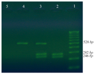 <p>Figure 2. Restricted amplified fragments by Mnl1 enzyme. MnlI enzyme can digest the PCR products in at least 12 <em>hr</em> at the temperature of 37<em><sup>o</sup></em><em>C</em> and this enzymatic activity can be stopped by incubation for 20 <em>min</em> at a temperature of 65<em>&deg;</em><em>C</em>. Variant -3402T, or allele CYP2C19*17 was resistant to MnlI digestion, therefore 528 <em>bp</em> fragment remained intact and it did not break, while the CYP2C19*1 allele was broken into two pieces of 246 and 282 <em>bp</em>. The digested products were separated on 2% agarose gel and the components were visible by Syber Green. 1 indicates the 100 <em>bp</em> DNA ladder; 2 is a wild type genotype (CC); 3 is a heterozygote CT and 4 is TT genotype; 5 is a negative control.</p>
