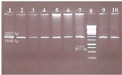 <p>Figure 1. Representative samples tested for common &alpha;-globin gene deletions.</p>
<p>Well 1. Heterozygote for -&alpha;<sup>3.7</sup> with &alpha;&alpha;/-&alpha;<sup>3.7 </sup>genotype</p>
<p>Well 2, 3, 4, 5, 6, 9 and 10. No of &alpha;-globin gene deletion, there are guest normal alpha alleles</p>
<p>Well 7. One -MED deletion with &alpha;&alpha;/-MED genotype</p>
<p>Well 8. Ladder</p>
