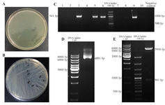 <p>Figure 3. Sub cloning of <em>DPPA2</em> gene in pRUF expression vector, A. Negative control plate; B. Sub cloning plate of <em>DPPA2</em> gene; C. Colony PCR for confirming recombinant colonies, D. The size of pRUF vector was increased to 6891 <em>bp</em> after insertion of <em>DPPA2</em> gene, E. Digestion of recombinant pRUF-DPPA2 plasmid by BamHI and XhoI gives 2 bands that correspond to Pruf expression vector (5950 <em>bp</em>) and <em>DPPA2</em> gene (941 <em>bp</em>).</p>