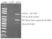<p>Figure1. Reverse Transcription (RT)-Polymerase Chain Reaction (PCR). RT-PCR was performed using primer set F/R for 5637 cells. The predicted PCR product sizes were 1420, 1195, 790/796 and 550-bp corresponded for OCT4B1, OCT4B-variant2, OCT4B-variant3/ OCT4B2 and OCT4B3, respectively. Ladder is DNA marker 100-bp, and no-RT sample was used as a control to confirm absence of DNA contaminations.</p>
