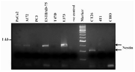 Figure 3. Expression of nestin in different cell lines by RT-PCR. The standard marker is DNA molecular weight marker XVI from Roche. The negative (-ve) control was PCR reaction without any template