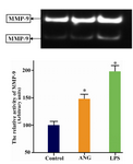 Figure 2. Zymographic determination of MMP-9 in culture media of U-937 cells. 1×106 serum starved cells were seeded in 12-well plates and treated either with LPS (100 ng/ml) or ANG (100 nmolar) for 24 hr. A representative zymogram has been shown (upper panel). Data are presented relative to control as mean±SEM (n=4) following densitometry. * p<0.05 vs. control. ANG= Angiotensin II, LPS = Lipopolysaccharide