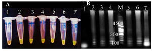 <p>Figure 1. The detemination of LAMP products. A) visual detection after addition of SYBR green dye without UV illumination. Tube 1: negatine control, tube 2: positive control, tube 3, 4, 5, 6 and 7: LAMP amplification products from positive urine samples. B) Analysis on 1% agarose gel electrophoresis. lane 1: negatine control, lane 2: positive control, lane 3, 4, 5, 6 and 7: LAMP amplification products from positive urine samples., M: 100 <em>bp</em> DNA ladder.</p>