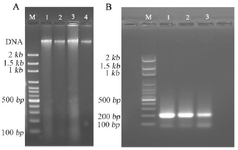 <p>Figure 1. Examining the quality of DNA and bisulfite-treated DNA amplicons. Quality of DNA was evaluated for extracted DNA (A) and bisulfite-treated DNA amplicons (B) using agarose gel (1% and 2%, respectively) electrophoresis and staining with gel red dye. (A): A single, high molecular weight DNA band was detected with no evidence of shearing and RNA contamination (Lanes 1&ndash;4). <em>M: </em>100 <em>bp</em> DNA ladder marker. (B): The DNA amplicons were detected as a single DNA band related to <em>TGM-3</em> gene amplification, comparable to 200 <em>bp</em> band (Lanes 1&ndash;3). <em>M: </em>100 <em>bp</em> DNA ladder marker.</p>