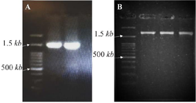 <p>Figure 2. Gel electrophoresis results. A) PCR products of the first fragment (exons 1-6). B) PCR products of the second fragment (exons 5-10).</p>