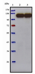 Figure 5. Western blot analysis of purified anti-P110 antibody. Bacterial cell lysate from M.genitalium G-37 was prepared by sonication and subjected to Western blot. Polyclonal anti-P110 antibody detected a specific band of 110 kDa. Lane 1) Protein marker (Fermentas). Lane 2) Reducing conditions. Lane 3) Non-reducing conditions 

