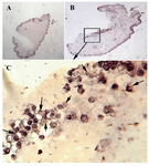 Figure 8. Effect of perfusion bioreactor culture on collagen type II. The control A) exhibited less immunostaining for type II collagen then bioreactor group B, C) (magnification of A, B are 5× and C 20×)
