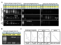 Figure 5. A similar protocol comprising (NH4)2SO4, MgCl2, betaine and DMSO in PCR reaction was applied for efficient amplification of different loci in human genome. The same PCR reaction conditions of figure 2 was fulfilled to amplify several regions from human Androgen receptor, Eukaryotic Releasing Factor 3a, and Elongation Factor 1a (A). The same PCR conditions of figure 5A (lanes 1) was repeated using 1.5-4mM MgCl2 in Pfu buffer, to obtain a product band for Elongation Factor 1a with higher intensity (B).  Two different predicted secondary structures graphs of target DNA as notified in figure 1 were obtained for nucleic acid folding and hybridization prediction. The internal energy required for formation of these constructs is indicated as kcal/mole.  Please note that in case of Eukaryotic Releasing Factor 3a, only one type of secondary structure was suggested by software