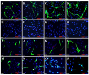 <p>Figure 5. Immunocytochemistry analysis of differentiated bone mar-row stromal cells into oligodendrocyte like cells. Fluorescence images of oligoprogenitor markers (Olig2 and A2B5) and mature oligo-dendrocyte markers; (CNP and MBP) in experimental group (A-D); Negative Control 1 (E-H) Control 2 (I-L), and Control 3. (M-P). Scale bars 10 <em>&mu;m.</em></p>