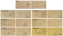 <p>Figure 7. Microscopic images of HeLa cell lines after 72 <em>hr</em> of treatment with different concentrations of CS extract, scale bar: 50 <em>&micro;m.</em></p>