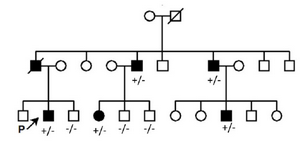 <p>Figure 2. Pedigree related to the family with clinically affected CFEOM (1A). (+/-): Affected, (-/-): Wild type.</p>