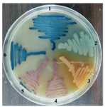 <p>Figure 3. Gram-negative bacteria on CHROMagar surface after 24 <em>hr</em> of incubation at 37<em>&deg;</em><em>C</em> isolated from urine of outpatients infected with urinary tract infection. 1- <em>K. pneumoniae</em> 2- <em>P. aeruginosa</em> 3- <em>Proteus </em>4- <em>E. coli</em> 5- <em>C. freundii</em> 6- <em>E. aerogenes</em>.</p>