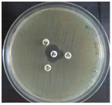 <p>Figure 6. Positive result of ESBL-producing <em>K. pneumoniae</em> by DDST on Muller Hinton agar surface after 24 <em>hr</em> of incubation at 37<em>&deg;</em><em>C</em>. CRO: Ceftriaxone 30 <em>&mu;g</em>.<em>, </em>CTX: Cefotaxime 30 <em>&mu;g</em>, CAZ: Ceftazidime 30 <em>&mu;g</em> AMC: Amoxi/Clavulanic acid 30 <em>&mu;g</em>.</p>