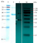 <p>Figure 3. Left picture: SDS PAGE for purified recombinant protein. Lane 1: Protein marker and Lane 2 shows the protein 38 <em>kDa</em> (<em>CagA</em>). Right picture: Image related to Western blotting technique for confirmation of <em>CagA</em> expression.&nbsp; Lane 2:&nbsp; It corresponds to protein 38 <em>kDa</em> (<em>CagA</em>), and Lane M: Protein marker.</p>