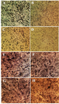 <p>Figure 2. Morphological alterations of A2780cp ovarian cancer cells and NIH3T3 fibroblast cells under exposure to inhibitory concentrations of <em>O. scolopendrina</em> polysaccharide and taxol using MTT assay. Reduction of the amount of formazan crystals in cancer cells compared with the untreated cells demonstrated anti-proliferative effect under inverted microscope (Magnification &times;200). The emergence of high formazan crystals in NIH3T3 treated cells revealed the effect of extracted polysaccharide and taxol on ovarian cancer cells. A, E) Control, B, F) 10 <em>&micro;g/ml</em> taxol, C, G) 30 <em>&micro;g/ml</em> polysaccharide, D, H) 10 <em>&micro;g/ml</em> taxol +12.5 <em>&micro;g/ml</em> polysaccharide.</p>