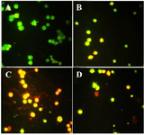 <p>Figure 4. Acridine orange/propodium iodide staining indicated the apoptosis induction under treatment with polysaccharide and taxol. The untreated cells are green and indicator of live cells, yellow and orange color indicates apoptosis (Magnification &times;400). A) Control, B) 10 <em>&micro;g/ml</em> taxol, C) 30 <em>&micro;g/ml</em> polysaccharide, D) 10 <em>&micro;g/ml</em> taxol +12.5 polysaccharide <em>&micro;g/ml</em>.</p>