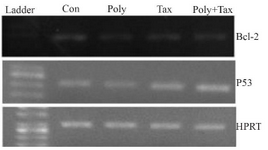 <p>Figure 7. A2780cp cells were treated with <em>O.</em> <em>erinaceus</em> extracted polysaccharide, taxol and synergistic treatment. The mRNA expressions of Bax and Bcl-2 were assessed by RT-PCR that demonstrated cytotoxic effect of polysaccharide, taxol and co treatment via intrinsic pathway (con= control or untreated cells, poly=30 <em>&micro;g/ml</em> brittle star polysaccharide, tax=10 <em>&micro;g/ml</em> taxol or paclitaxel, poly+tax=co treatment of 10 <em>&micro;g/ml</em> taxol and 12.5 <em>&micro;g/ml</em> polysaccharide).</p>