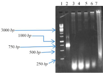 <p>Figure 1. Colony PCR from random selected colonies on 1% agarose gel: Lane 1; Fermentas 1 <em>Kb</em> DNA Ladder, Lane 3, 4, 5, 6 and 7; ne-gative colonies, Lane 2; positive colonies.</p>
