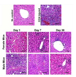 <p>Figure 2. Comparison of liver histology between the control, liver failure model, and male and female cell-treated groups. CCl4 treated group showed hepatocyte cytoplasm vacuoliza-tion, and infiltration of inflammatory cells. During 30 days the cell transplantation significantly ameliorated liver injury with-out any significant difference between both genders. Scale bar: 100 &micro;m.</p>