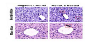 <p>Figure 6. Immunohistochemical staining of mitochondrial pro-tein (red box) in liver samples retrieved from male and female MenSCs-treated groups after 7 days. Liver section from normal mice served as negative control. Scale bar: 100 &mu;m.</p>