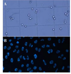 <p>Figure 4.&nbsp; Cells on a Neubauer chamber under the microscope, A) all the cells, B) DAPI stained cells under the fluorescent filter.</p>