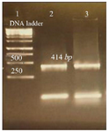 <p>Figure 3. Amplification products of&nbsp; <em>L. tropica</em> V-ATPase subunit F on 2% agarose gel electrophoresis stained with ethidium bromide. Lane 1: DNA ladder 1 <em>kb</em>, lane 2: V-ATPase subunit F amplification product, lane 3: V-ATPase subunit F- cDNA amplification product.</p>