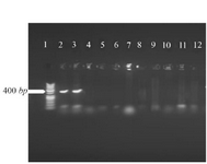 <p>Figure 6. Sequencing of V-ATPase subunit-F gene in&nbsp; <em>L.tropica.</em></p>
