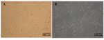 Figure 2. Human germ cell clusters to gather somatic cells at the 7th day of testis cells culture in SFM media. A) 10×10X; B) 10×20X