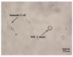Figure 3. Two weeks after specific culture of human spermatogonial stem cells in SFM. At the left, a somatic cell and at the right, a human germ cell colony are shown. (10×40X)
