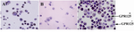 Figure 5. GPR125 immunochemistry staining. A) Hela cells as positive control; B) testis somatic cells derived from 86-year-old man as negative control; C) GPR125+ cells in specific culture of human spermatogonial stem cells after 52 days