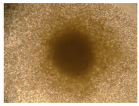 Figure 1. A clonal cell line that was derived from a single cell on semi-solid cloning matrix