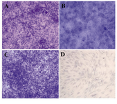 Figure 5 Chondrogenic differentiation after 21 day. In chon-droinductive culture, the metachromatic nature of the matrix was determined by the toluidine blue staining of glycos-aminoglycans as purple stained loci in bone marrow; A) (200×) liver; B) (400×) and adipose tissue; C) (200×) derived MSCs. No stained foci were observed in non induced cell cultures; D) (400×)