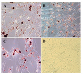 Figure 6. Adipogenic differentiation after 21 days. In adipogenic cultures, formation of lipid droplets within the cytoplasm of the cells was quite slow and were gradually occupied the whole cells. Accumulation of intracellular lipid droplets was determined as red loci following oil red O staining in bone marrow, A) Liver; B) and adipose tissue; C) derived MSCs (400×). No stained foci were observed in non induced cell cultures; D) (200×)