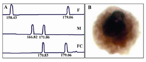 Figure 1. A) Informative STR marker applied to the paternal and maternal DNA, to the DNA of the born baby, F: father, M: mother, FC: fetal cell. B) Large KL1 positive cells identified