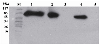Figure 5. Western blot analysis by ECL method of extracts from TOP10 E. coli transformed with the recombinant pBAD/gІІІA plasmids containing reteplase using mouse anti His antibody. M: Pre-stained standard molecular weight marker. Lane 1: Refolded rpBAD. Lane 2: Purified rpBAD. Lane 3: TOP10 E. coli bacteria (negative control). Lane 4: t-PA standard (positive control). Lane 5: BSA 0.01% (negative control)