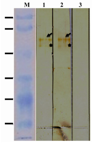 Figure 2. Immunoreactivity of rROP1. Purified rROP1 was analyzed by SDS-PAGE, transferred onto PVDF membrane and probed with pooled sera from pregnant women with acute (lane 1), chronic (lane 2) and no T. gondii infection (lane 3). 
*Degraded ROP1 is marked with star
