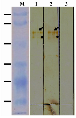 Figure 2. Immunoreactivity of rROP1. Purified rROP1 was analyzed by SDS-PAGE, transferred onto PVDF membrane and probed with pooled sera from pregnant women with acute (lane 1), chronic (lane 2) and no T. gondii infection (lane 3). 
*Degraded ROP1 is marked with star
