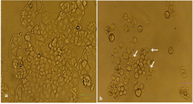 Figure 4. (a) Normal OVCAR3 cell line. (b)Apoptotic forms of OVCAR3 cell line observed by invert phase-contrast microscope. Arrows show the morphologic signs of programmed cell death in early apoptosis