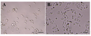 Figure 5. Morphology of isolated hAECs during the culture period. A) Isolated hAECs were cultured and their morphology was monitored immediately after culture; B) and after 48 hr. Scale bar; 50 µm
