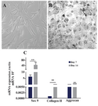 Supplementary figure 3. Differentiation of ASCs to chondrocytes. A) Adipose derived stem cells were observed as spindle shaped cells in culture before differentiation; B) ASCs changed morphologically through chondrogenic differentiation to the cuboidal shapes; C) Expressions of different chondrocyte related genes such as SOX9, collagen type II and aggrecan in ASCs on days 7 and 14 after treatment for chondrogenic differentiation. Data are shown as mean ± SEM of 2-∆∆Ct