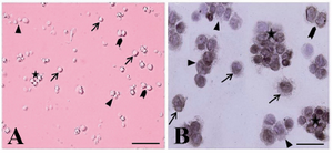 Figure 2. The cytological and immunocytochemical evaluation of spermatogonial stem cells using PGP9.5 immediately after isolation. The spermatogonia were seen as different forms: single (arrow, A, B), paired (arrowhead, A, B) align-ed (triangle, A, B) and cluster (asterisk, A, B). The isolated SSCs were round cells with a spherical nucleus, a high nucleus, cytoplasm ratio, and many cytoplasmic inclusions that tended to congregate and form small cell clusters