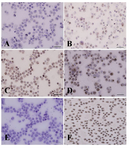 Figure 4. Immunocytochemical evaluation of differentiated type A spermatogonia in percoll separation method using c-kit antibody. The proportion of c-kit positive cells (brown cells) in A) 32%; B) 30%; C) 28% and D) 20% gradients were determined. The highest (D) and lowest (A) percentages of differentiated spermatogonia were found in gradients 32 and 20% respectively. Note that the strong and weak c-kit immunoreactivity was observed among the aggregated (Aal) and committed (A1-A4) spermatogonia, respectively. E) Negative and F) positive controls were detected